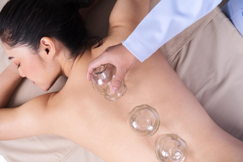 Cupping